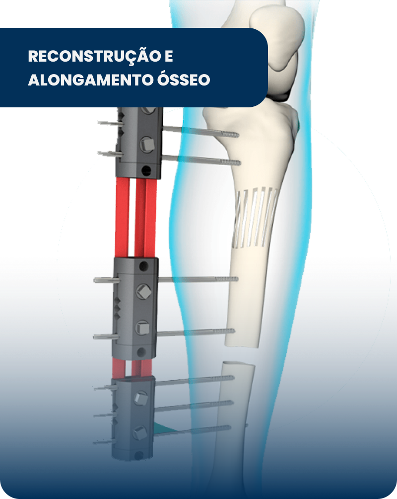 aLONGAMENTO (1)